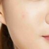COSRX Acne Pimple Master