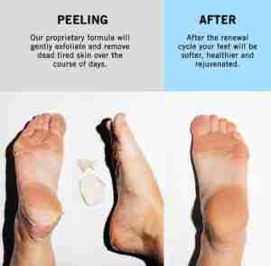 Holika Holika BABY Silky Foot One Shot Peeling 2